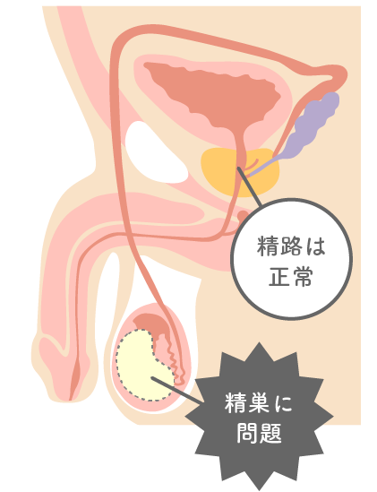 精液 男性不妊の原因：精子の異常・基準値について｜男性不妊｜医療 ...